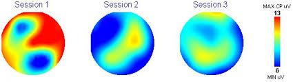The Complete Guide to LifeWave X39 Stem Cell Activation (2025 Edition)